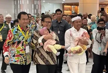 Operasi Bayi Kembar Siam asal Tasikmalaya Sukses Dipisahkan Di RS Hasan Sadikin